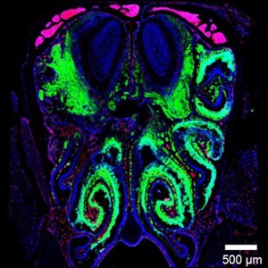 Микроглия обонятельной луковицы в защите мозга от инфекции