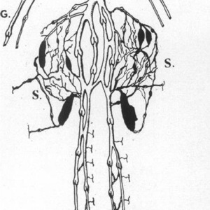 Мышечные вены голени - основная зона венозного стаза и инициации тромботического процесса