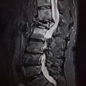 Немая эпидемия XXI века