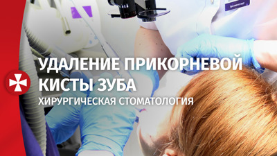 Хирургическая стоматология. Удаление прикорневой кисты зуба.