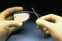 Имплантация однокамерного электрокардиостимулятора