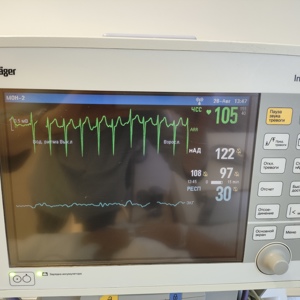 Нужна ли рутинная инвазивная тактика для пожилых пациентов с острым инфарктом миокарда без подъёма ST?