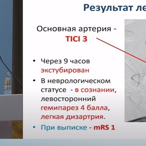Участие в Московском неврологическом конгрессе — 2021