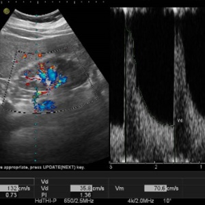 Рекомендации по проведению ультразвукового дуплексного исследования почечных артерий