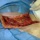 Хиурургическая обработка раны или инфицированной ткани