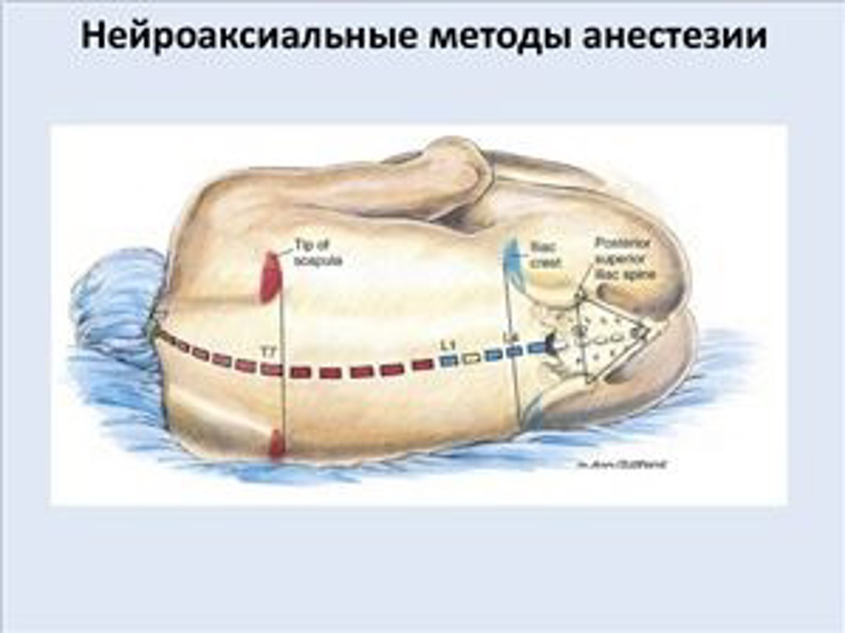 Проводниковая анестезия – Санкт-Петербург Dental House