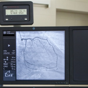 Памятка пациента с ишемической болезнью сердца, перенесшего операцию по стентированию коронарных сосудов