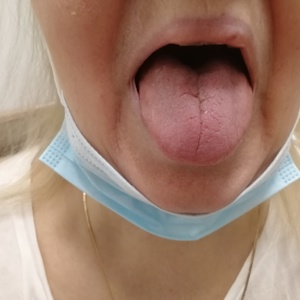 Диагностический поиск. Пять языков терапевта. Клинический случай.