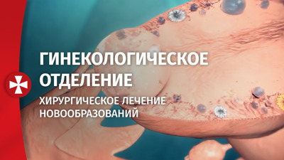 Гинекологическое отделение. Хирургическое лечение новообразований.