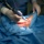 Хирургическая обработка раны (инфицированной ткани) методом ультразвуковой кавитации