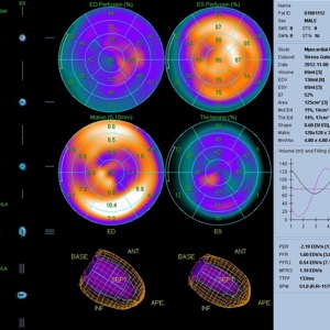 Однофотонная эмиссионная компьютерная томография в современном диагностическом процессе