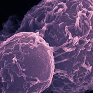 Применение нестероидных противовоспалительных препаратов для профилактики колоректального рака